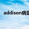 addison病是什么病的简称（addison病）