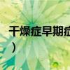 干燥症早期症状表现有哪些（干燥症早期症状）