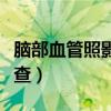 脑部血管照影是做什么检查（照影是做什么检查）