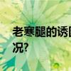 老寒腿的诱因与秋裤有关吗？ 具体是什么情况?