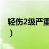 轻伤2级严重吗（轻伤一级和轻伤二级哪个重）