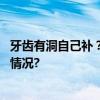 牙齿有洞自己补？网上“治牙神器”千万别信！ 具体是什么情况?