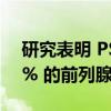 研究表明 PSMA PET/CT 成像改变了近 50% 的前列腺癌患者的管理